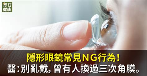 隱眼缺一角|隱形眼鏡常見NG行為！醫：別亂戴，曾有人換過三次。